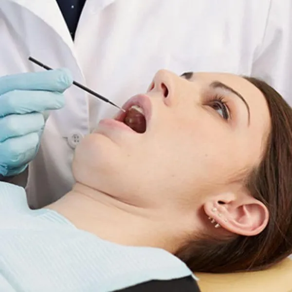 microbrush-x-extended-reach-applicator-clinical-close-px100-600x600 Young Innovations