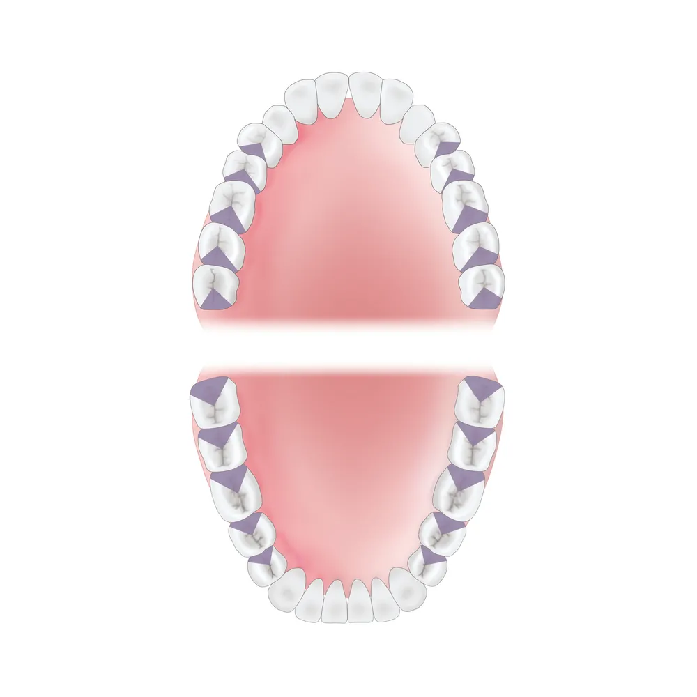 mouth-area-distal Young Innovations