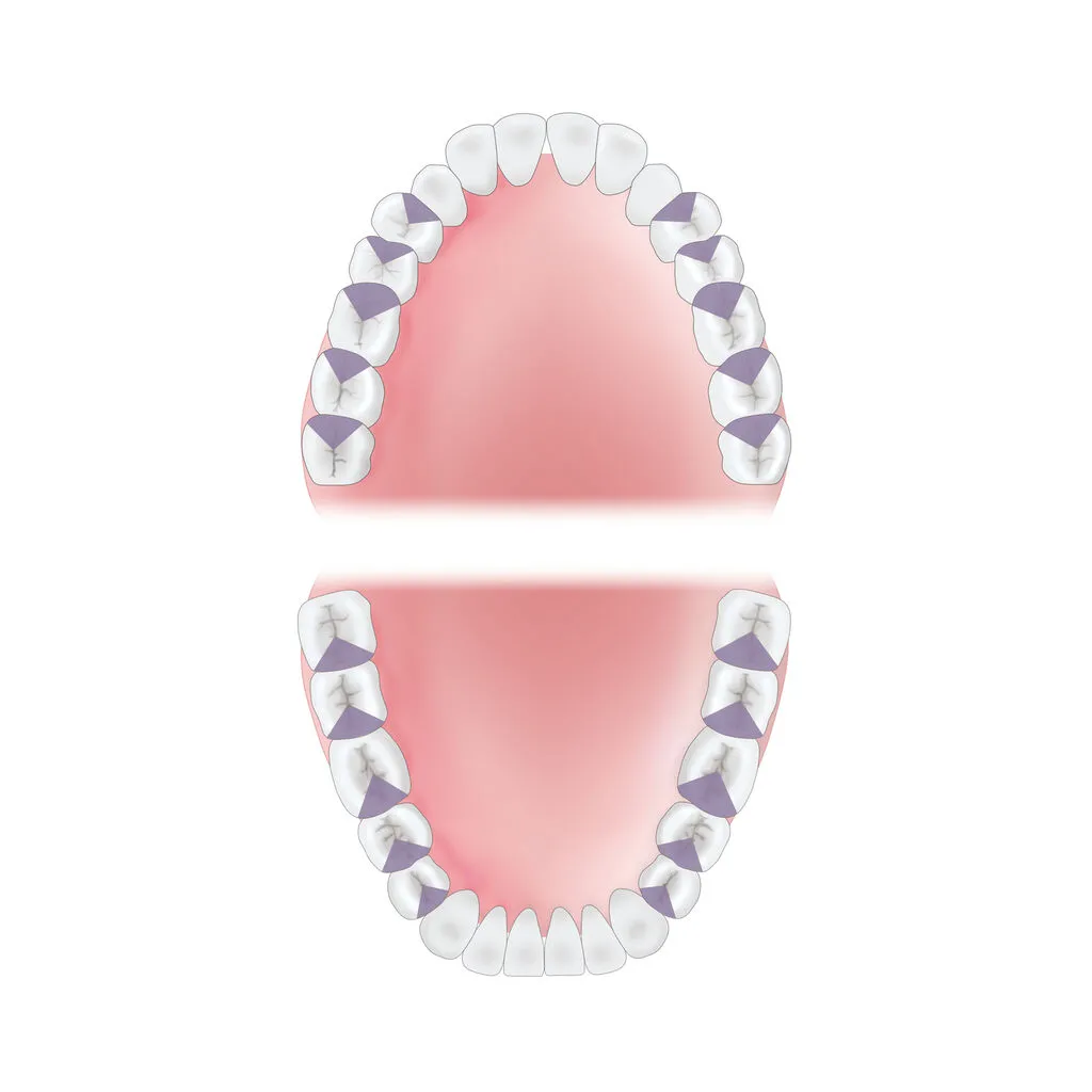 mouth-area-mesial Young Innovations
